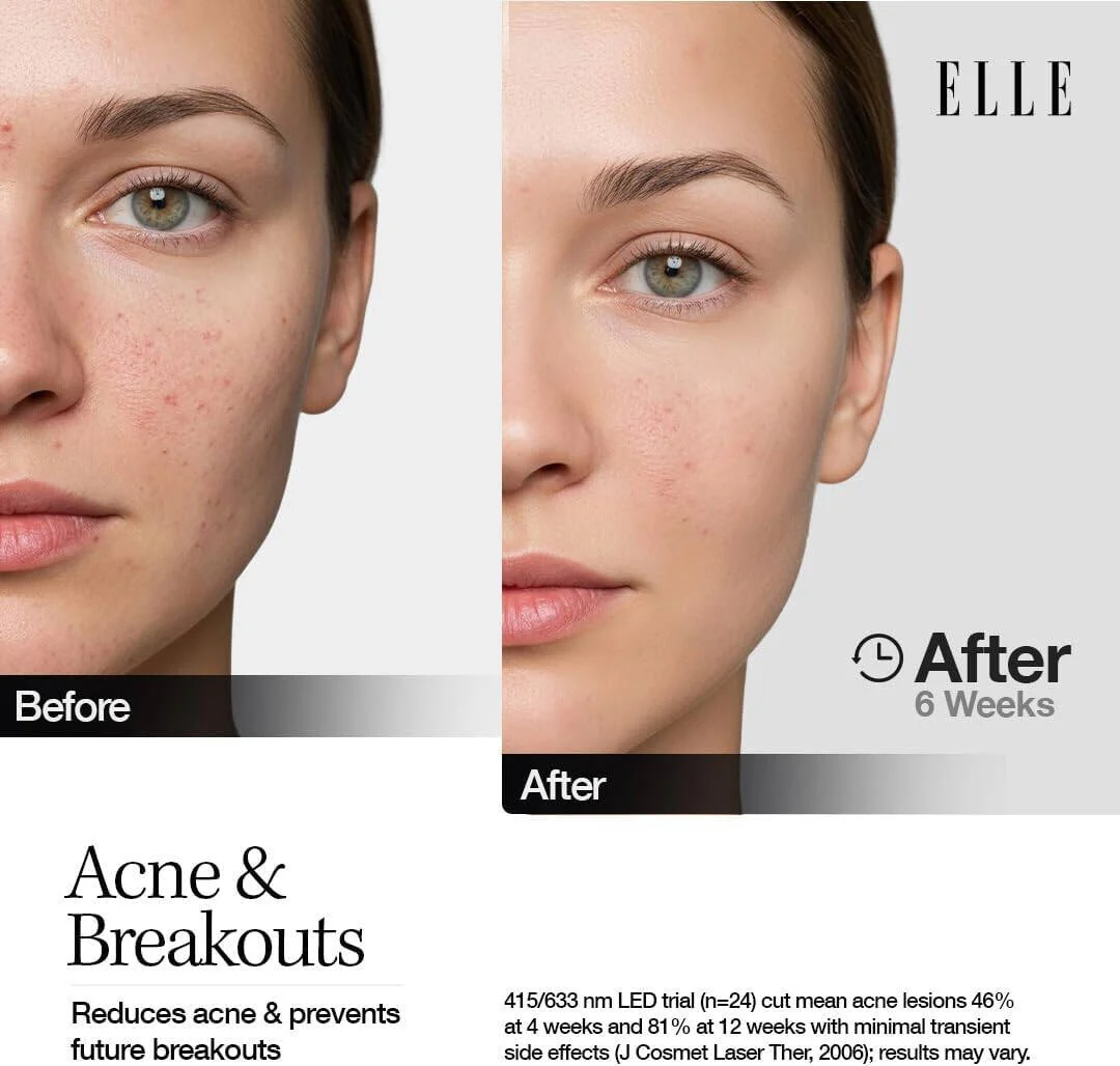 ELLE, Radiance Boost Pro Facewear LED Mask