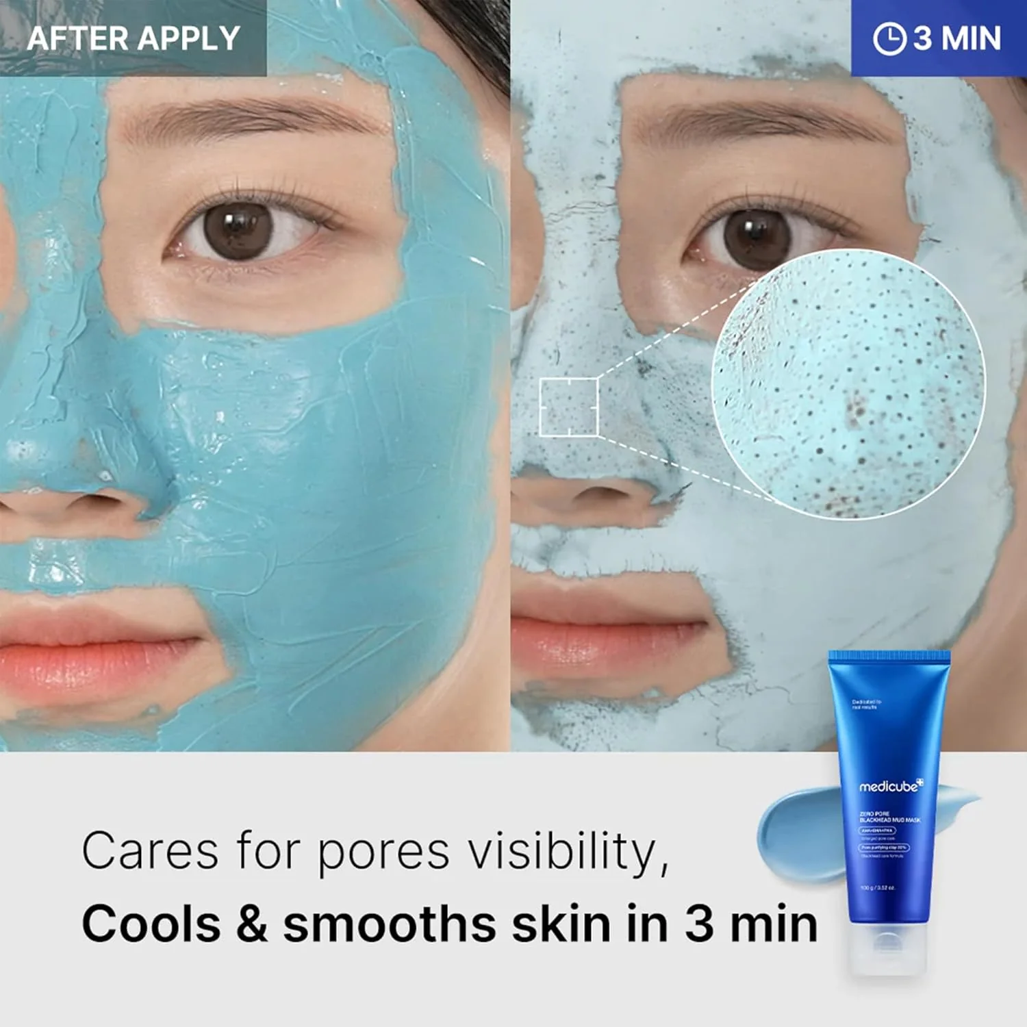Medicube, Zero Pore Blackhead Mud Mask, 100g