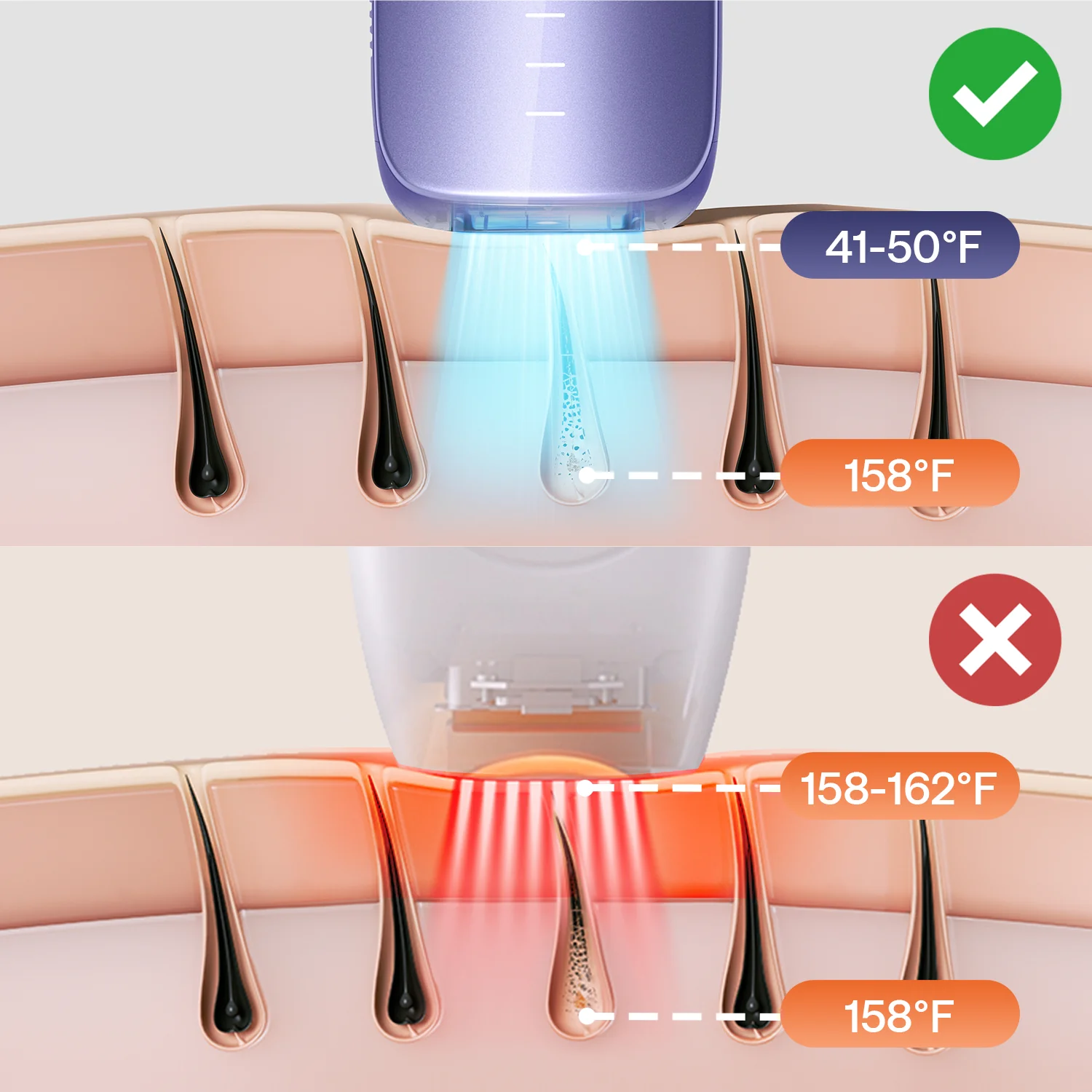 ULIKE Sapphire Air 3 IPL Hair Removal Device Without Leather Case,Purp