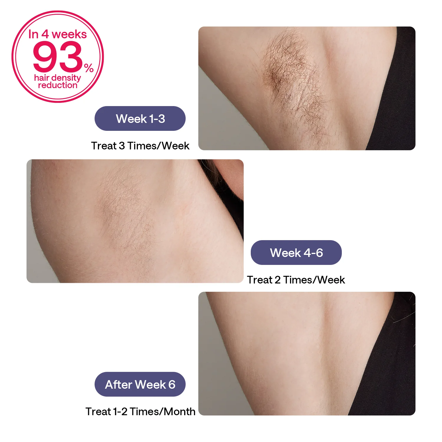 ULIKE Sapphire Air 3 IPL Hair Removal Device Without Leather Case,Purp