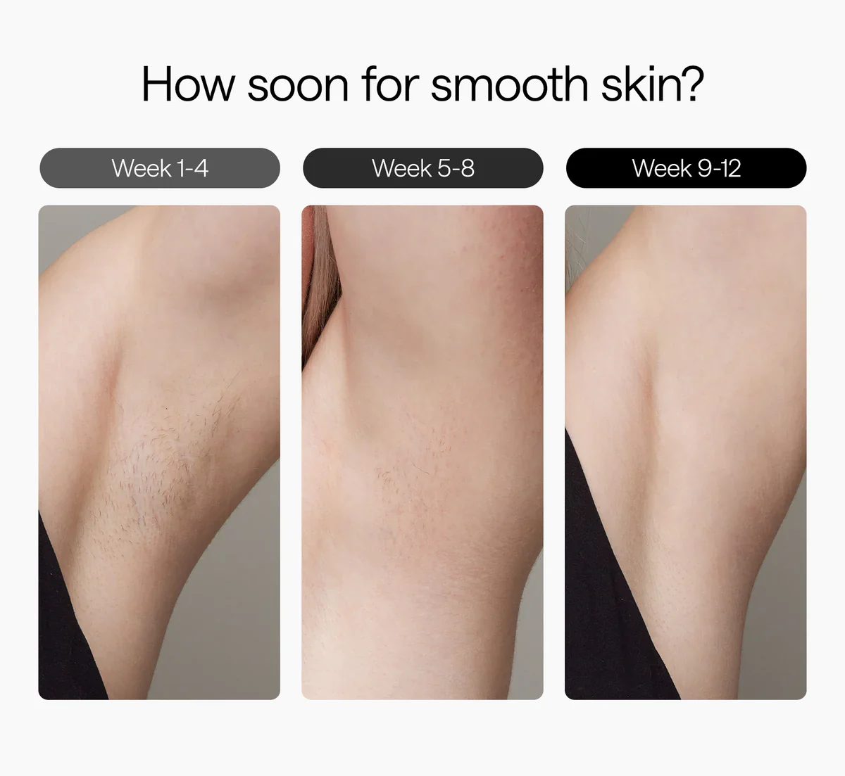 Ulike Air 3 IPL Laser Hair Removal, For Women and Men, With Sapphire Ice-Cooling System, Painless & Long-Lasting Result, Flat Head Window for Body& Face Usage, Visible Result in 3 Weeks